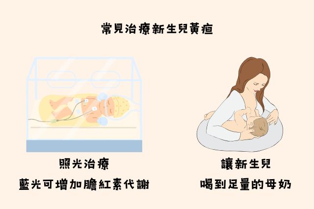 常見新生兒黃疸治療方法