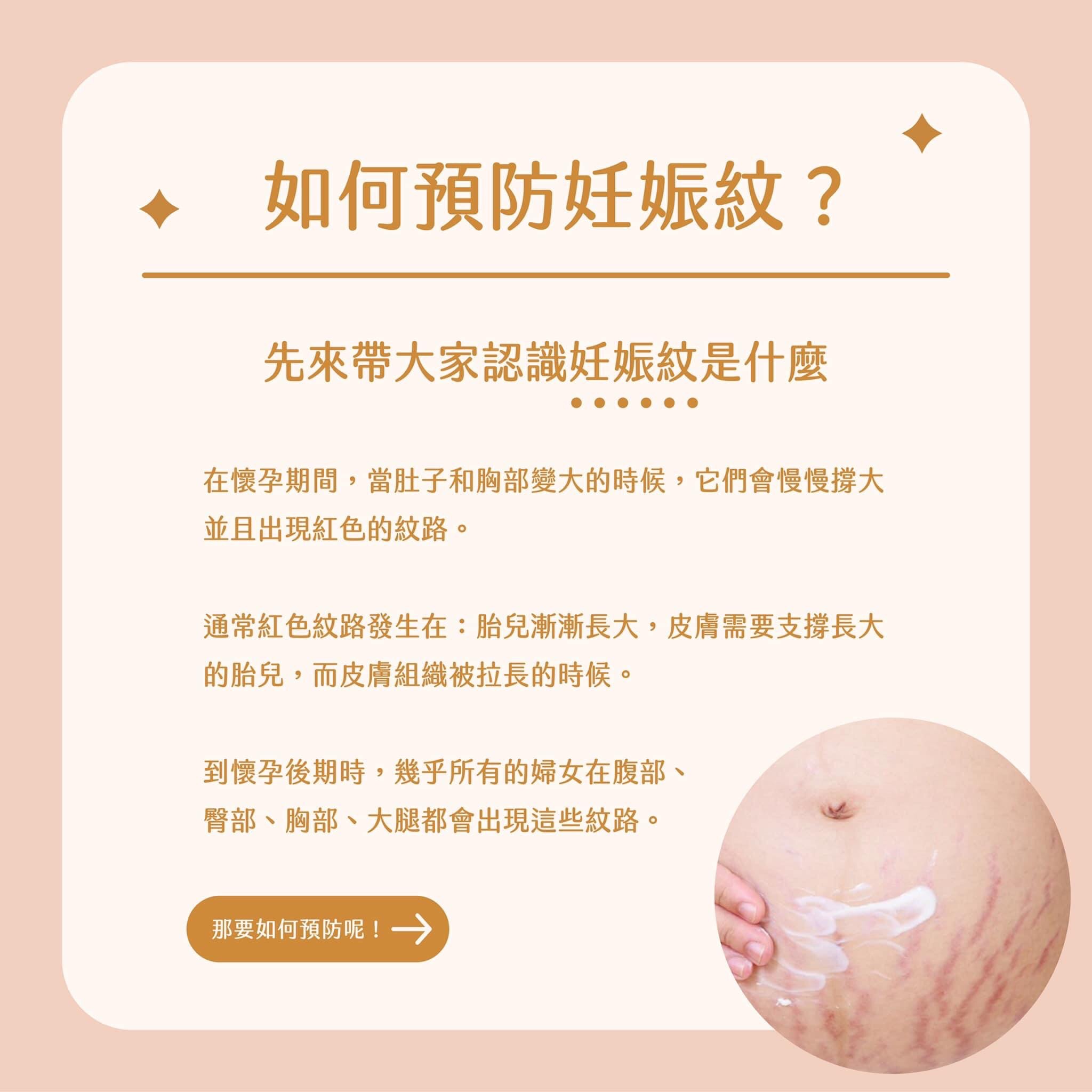 如何預防孕期及產後妊娠紋？教妳3妙招